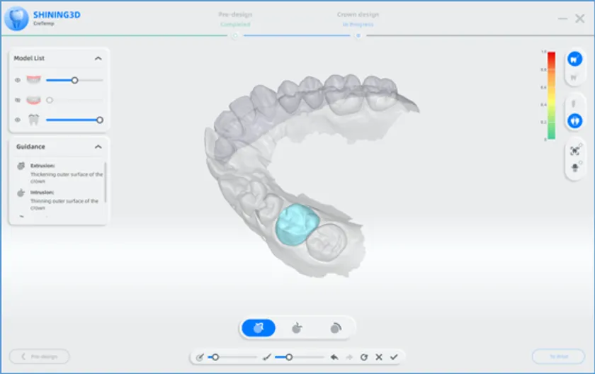 デジタルデンチャーの製作背景