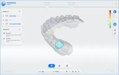 デジタルデンチャーの製作背景
