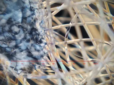 撮影例(マスクの繊維)