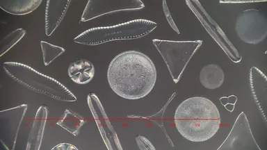 撮影例(プランクトン・珪藻)