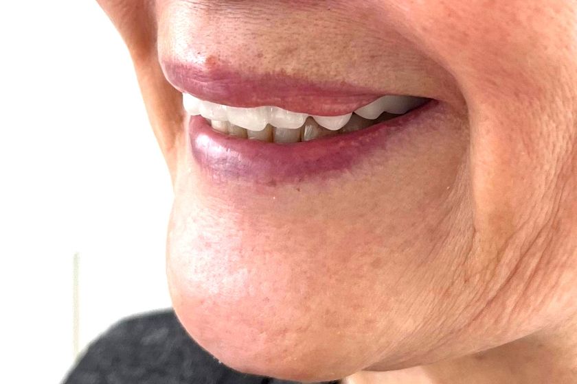 被災時にデジタルデータが命を救う!大規模災害時は義歯無償提供
全国に広がる「入れ歯銀行」、開始3年で保管数640個