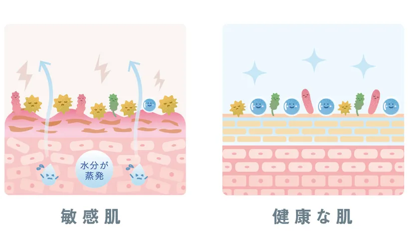 健康肌と敏感肌の肌状態比較