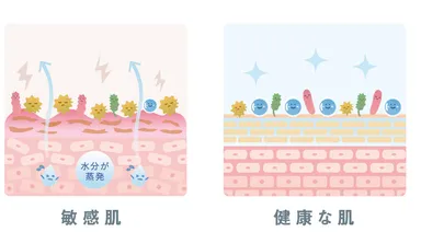 健康肌と敏感肌の肌状態比較