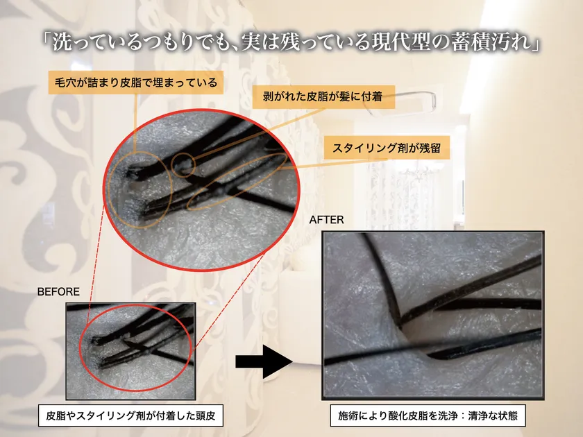 マイクロスコープ