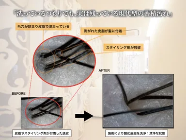 マイクロスコープ