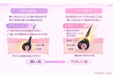 IPL脱毛とLED脱毛