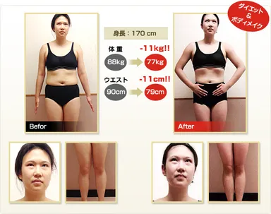 ビフォーアフター1 ※結果には個人差があります