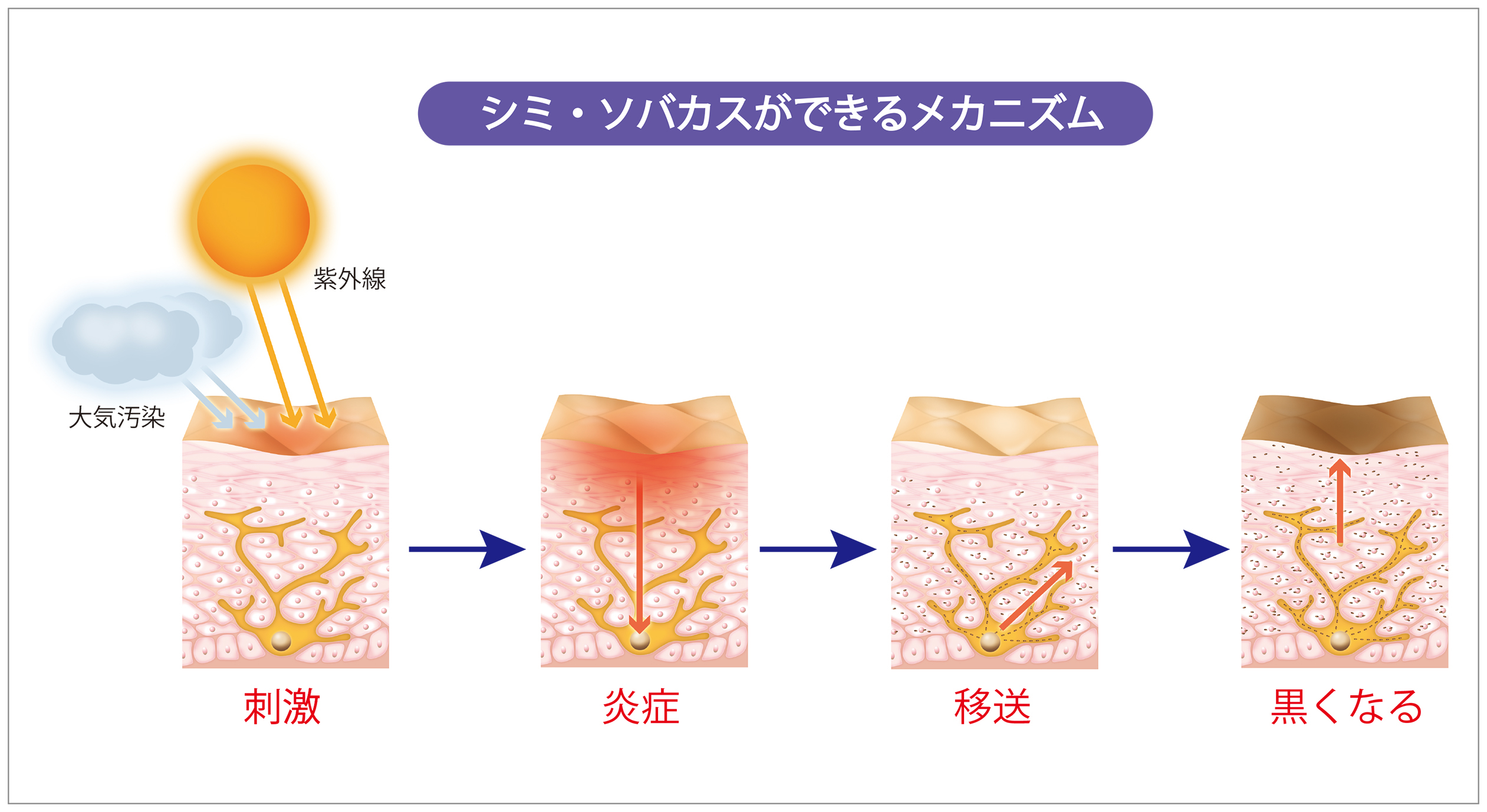 シミ・ソバカスができるメカニズムを徹底的に考えた「ノエビア トゥブラン薬用シリーズ」誕生！｜ノエビアグループのプレスリリース