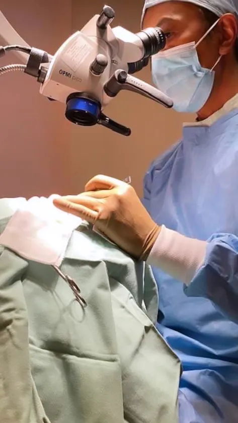 手術のイメージ