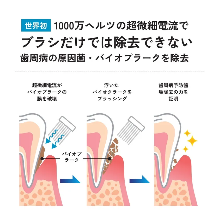 歯周病の原因菌・バイオプラークを除去