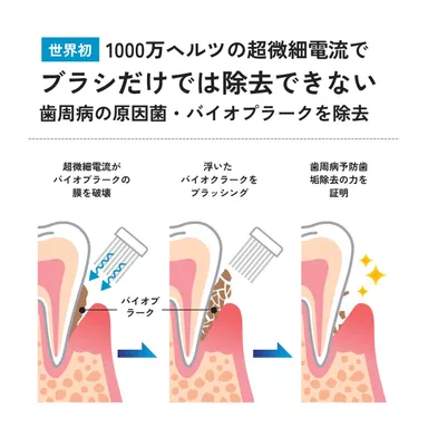 歯周病の原因菌・バイオプラークを除去