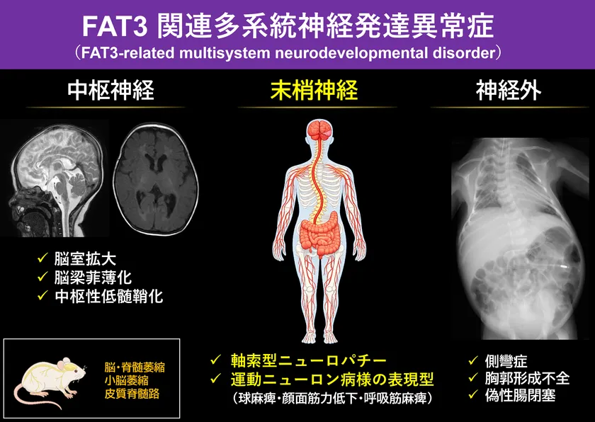 図1:FAT3遺伝子の異常による多系統神経発達障害 FAT3遺伝子の異常により、脳・神経・骨格にわたる複数の障害が生じることが明らかとなった。脳の構造異常、末梢神経障害による筋力低下、側弯などの骨格異常が特徴である。