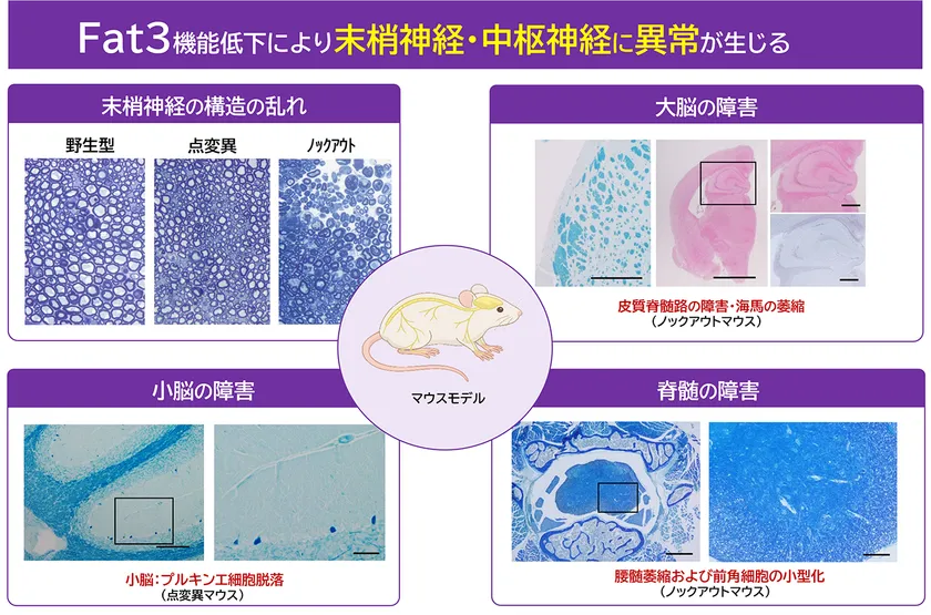 図3:マウスモデルによる神経系への影響 FAT3遺伝子の機能低下により、末梢神経の構造異常と、大脳・小脳・脊髄にわたる広範な神経障害が生じることが確認された。