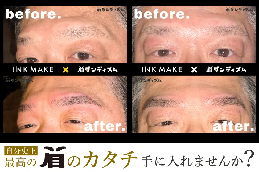 Before/After (1)