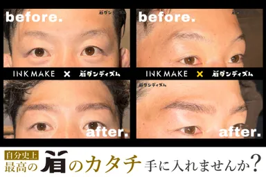 Before/After (2)