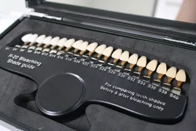 歯のトーン確認