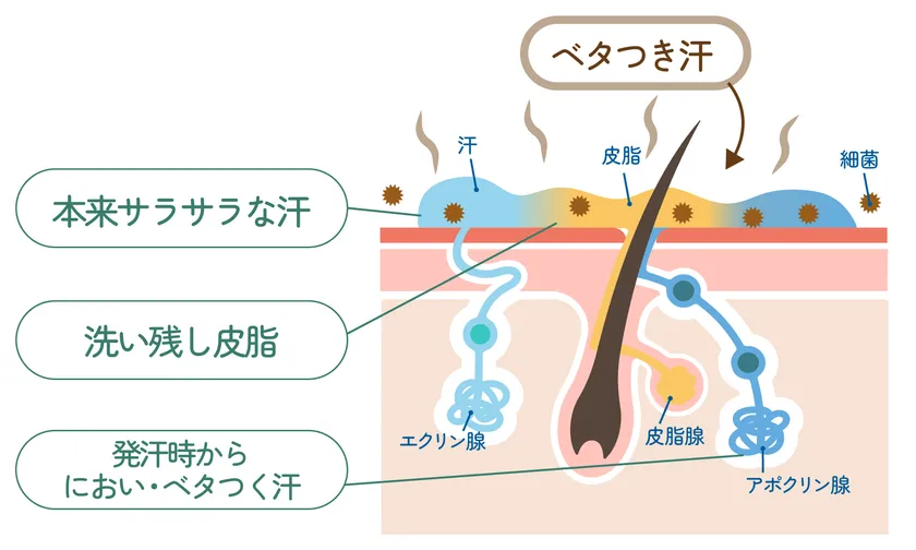 「洗い残し皮脂」とお風呂上がりの「サラサラ汗」が合体し、ベタつき汗に