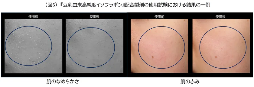 (図5)豆乳由来高純度イソフラボン配合製剤の使用試験における結果の一例