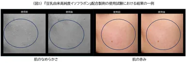 (図5)豆乳由来高純度イソフラボン配合製剤の使用試験における結果の一例