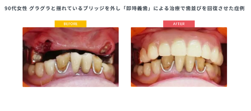 年金生活で「噛むこと」を諦める高齢者が増加
「保険で作れないと思っていた」相談が毎月15件以上
入れ歯保険診療「最後の駆け込み寺」が9/1相談会開始
