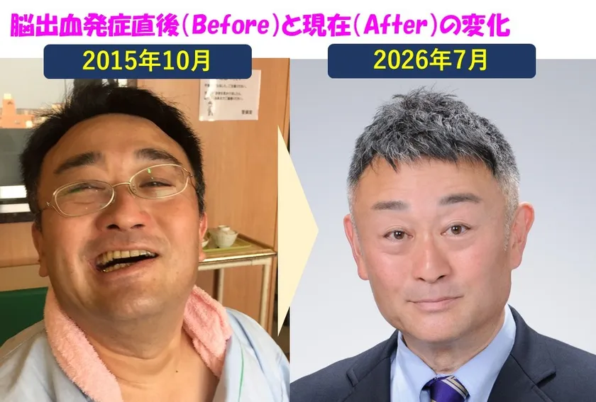 発症直後と現在の変化