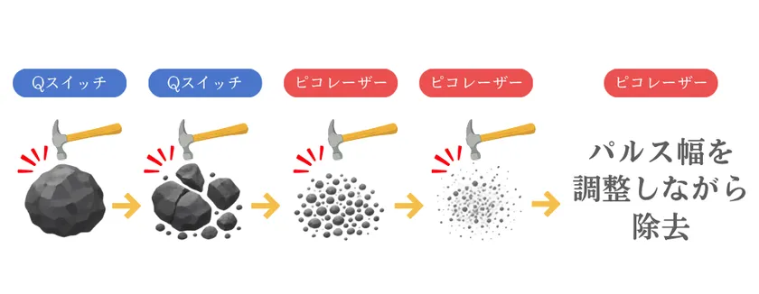 除去イメージ