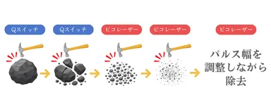 除去イメージ