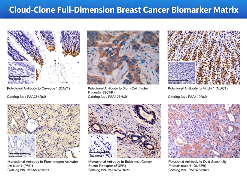 Cloud-Clone、技術革新を推進し、
乳がん精密研究の将来的な発展の道筋を描く