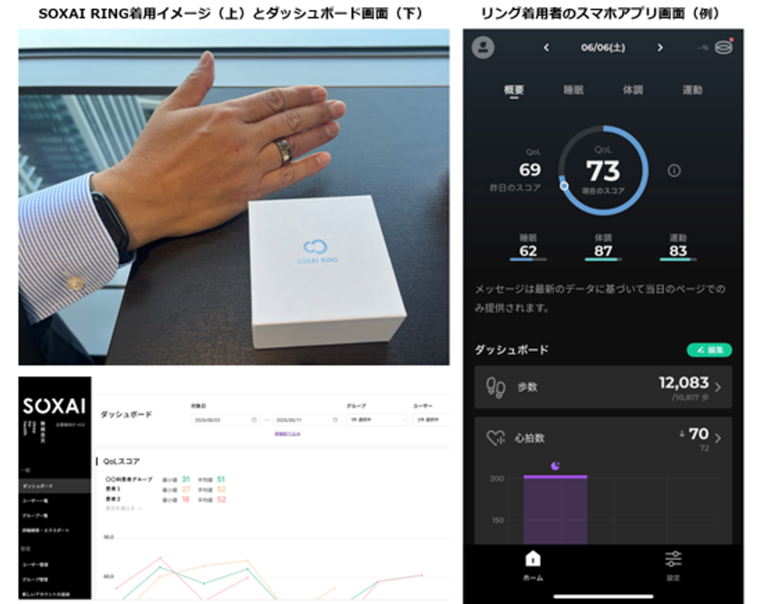 竹田健康財団とNTTドコモビジネス、スマートリングを活用した
術後患者の経過観察に関する実証実験を開始
