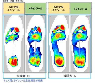 足圧分散図