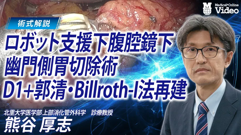 ロボット支援下腹腔鏡下幽門側胃切除術 D1＋郭清 Billroth-I法再建