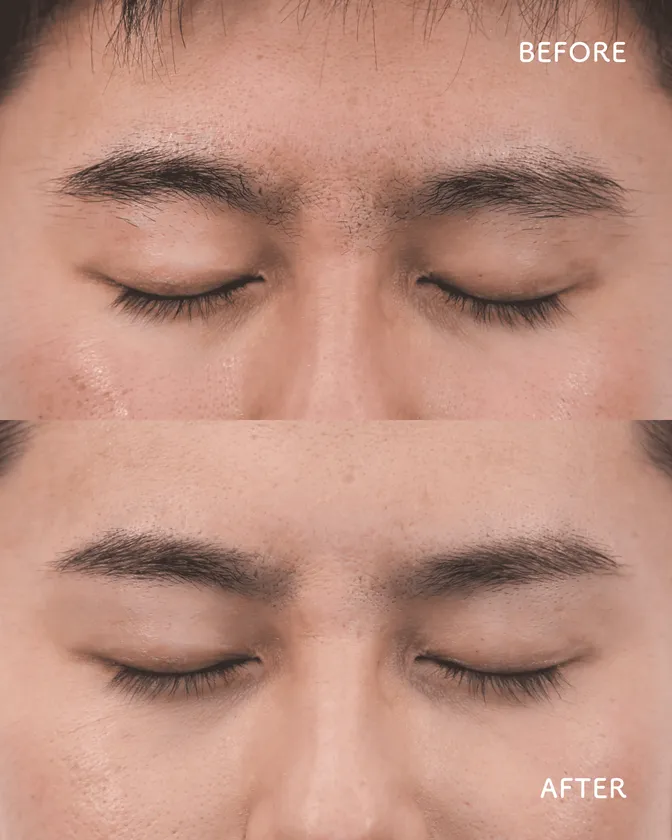 男性ビフォーアフター