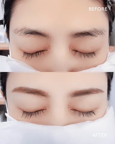 女性ビフォーアフター