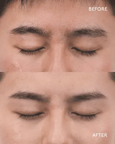 男性ビフォーアフター