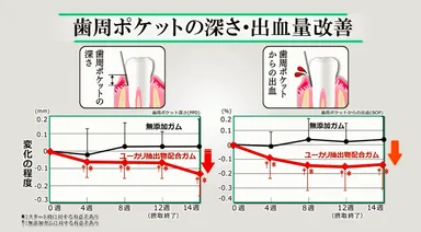 歯周ポケットの深さ・出血量改善