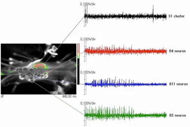 複数の脳神経部位がそれぞれ活動している様子を視覚化