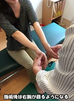 施術後は腕が回るようになる