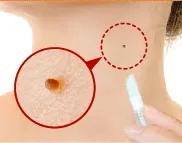 つぶぽろん使用イメージ1