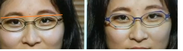 (左)左右対称の眼鏡・(右)左右非対称の眼鏡