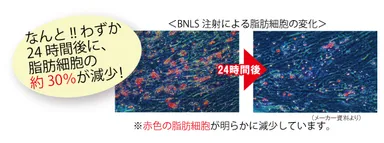 図8：BNLS注射による脂肪細胞の減少
