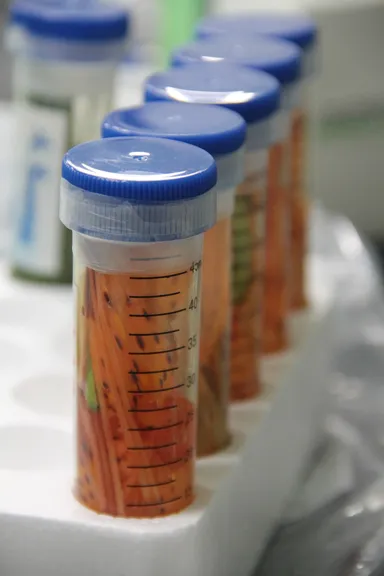 浜ユリ酵母の写真　NITE提供