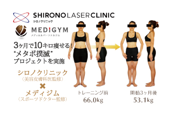 40代の男性 3人に1人が メタボ 女性は年齢と共に増加傾向に 美容皮膚科医 スポーツドクター のダイエットメニューで3ヶ月で10キロ痩せる メタボ撲滅 プロジェクトを実施 シーズ メディカルグループ シロノクリニックのプレスリリース