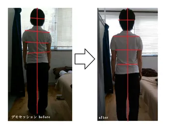 施術後の効果(例)