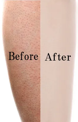 ご使用前　ご使用後