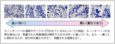 剥離角質細胞の光学顕微鏡観察