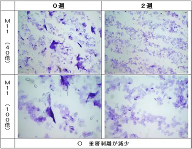 初期角質細胞の重層剥離が見られる被験者の改善例