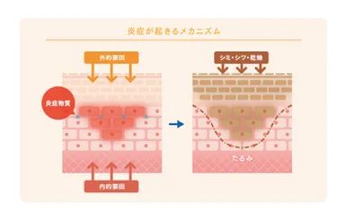 炎症が起こるメカニズム