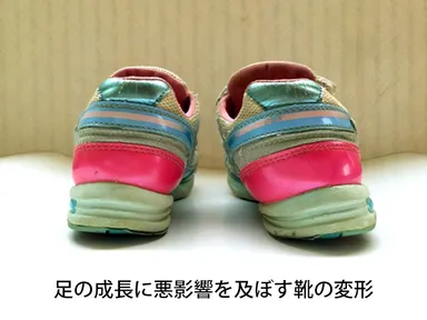 足の成長に悪影響を及ぼす靴の変形