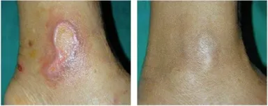 ビフォーアフター