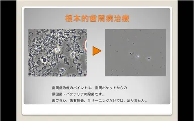 「Reset」イメージ